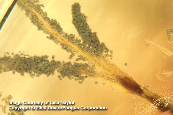 asperigillium.jpg